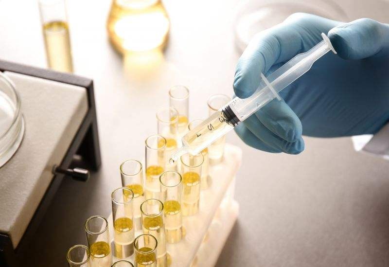 尿檢能檢測出來什么問題？