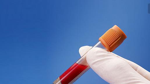 健康體檢一般檢查哪些項(xiàng)目？